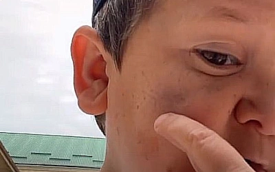 Хасбик заявил, что на него напали толпой