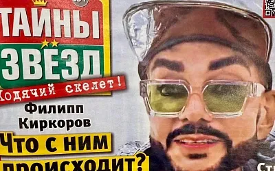 Филипп Киркоров шокировал публику: пластика, болезни или пиар?