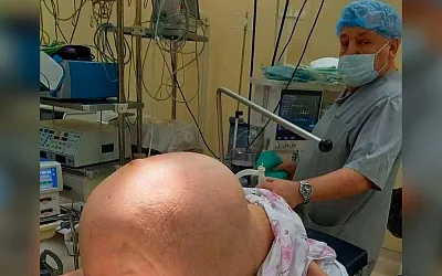 Врачи Новгорода удалили пациентке гигантскую опухоль объёмом 40 литров