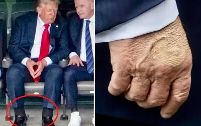 Что случилось с руками Трампа: объяснение Белого дома