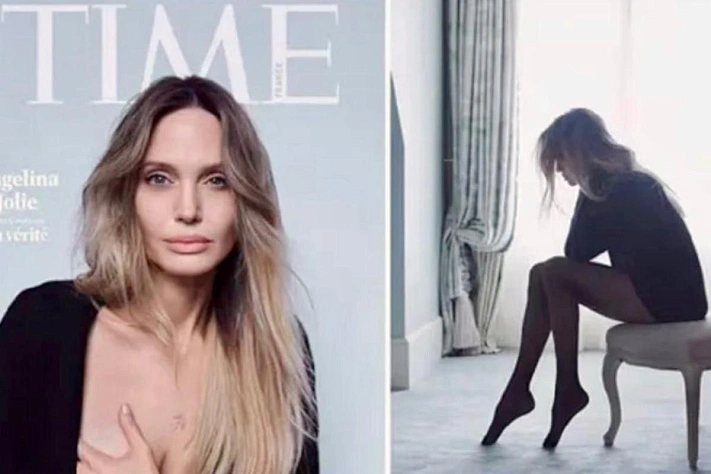 Анджелина Джоли показала шрамы после мастэктомии на обложке Time
