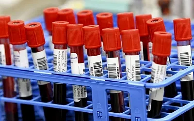 Толерантность к глюкозе и долголетие: как сахар в крови может влиять на жизнь