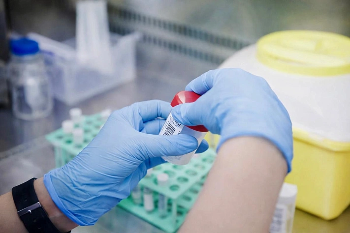 Оспу обезьян выявили у двух человек в Петербурге