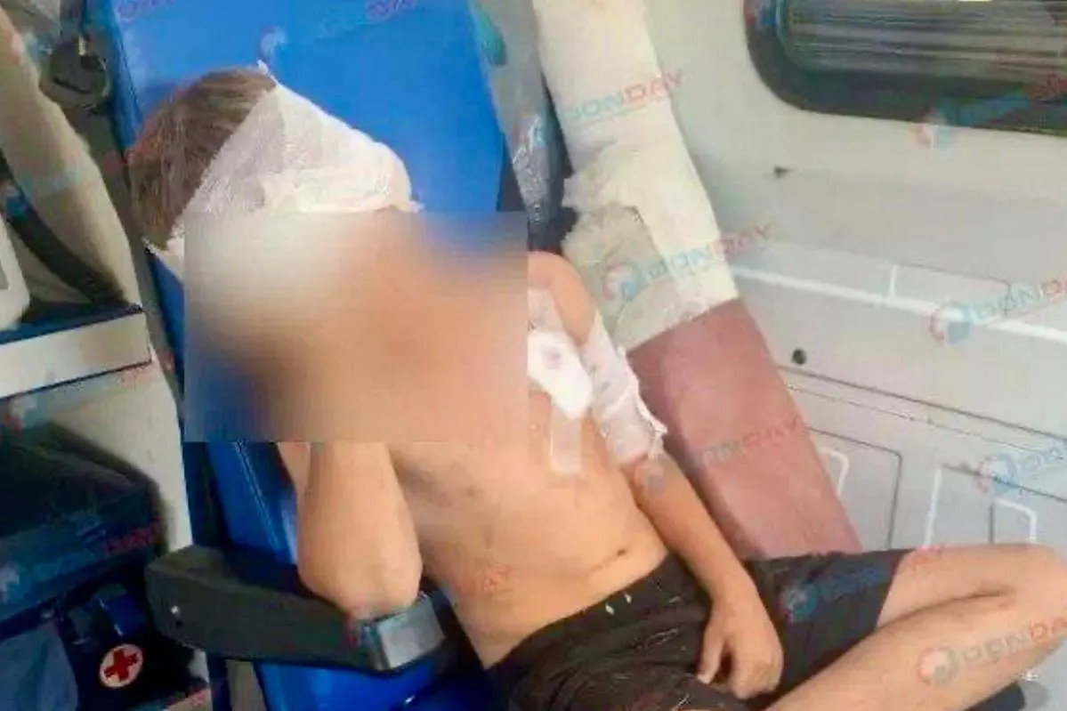 Волк из частного вольера напал на восьмилетнего в Гуково