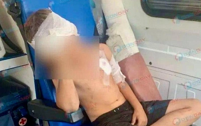 Волк из частного вольера напал на восьмилетнего в Гуково