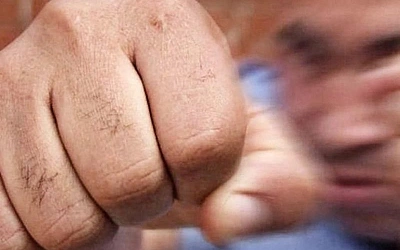 В Одинцово сломали нос следователю ГСУ СКР