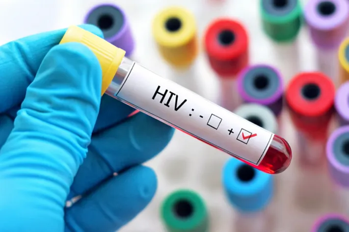 Каждый сотый взрослый россиянин живёт с ВИЧ