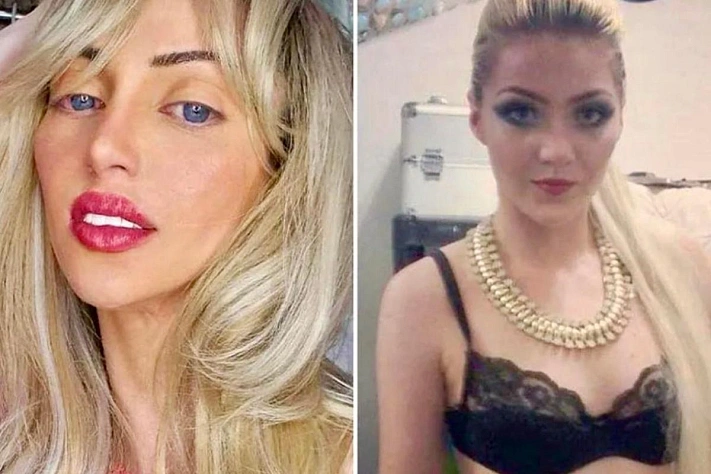 Смерть «живой Барби» в Сан-Паулу ставит вопросы к следствию