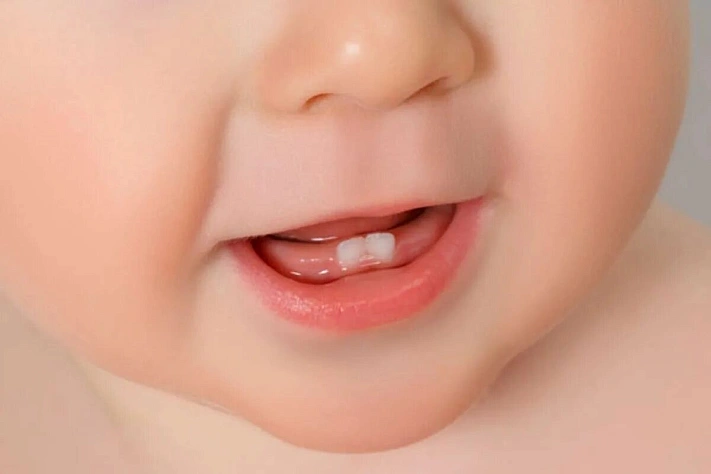 Это настоящие симптомы прорезывания зубов у детей