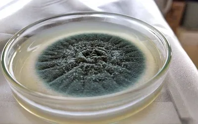 Опасный грибок Aspergillus: кто в группе риска и как избежать заражения