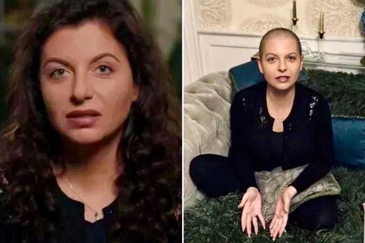 «Волос нет ни седых, ни каких-либо» и жизнь Симоньян после удара