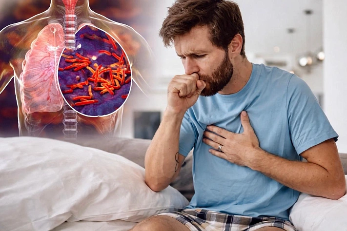 Туберкулёз никуда не ушёл и обманывает диагностику