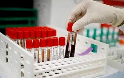 Французские учёные открыли новую группу крови: «Guada negative»