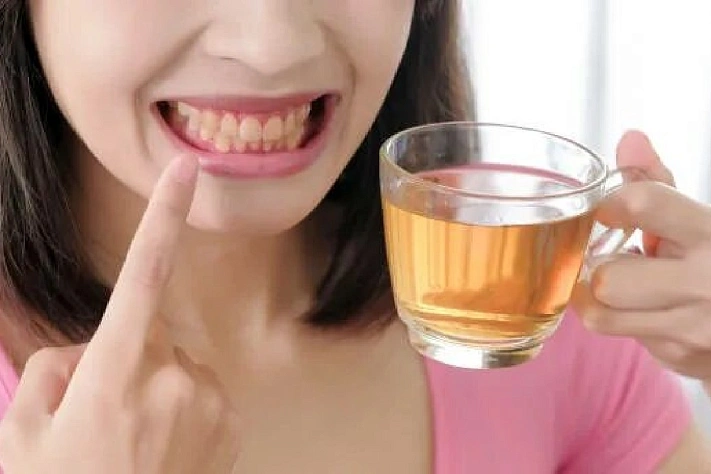 Эти продукты сильнее всего красят зубы