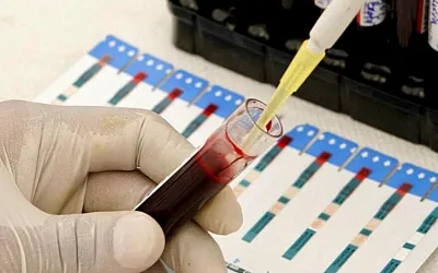 Кровь подскажет антидепрессант: израильский персональный тест