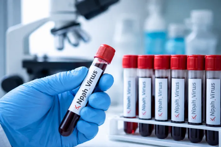 Роспотребнадзор не выявил завоз Нипаха в Россию