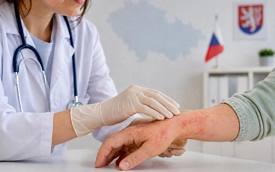 Чехия столкнулась с крупной вспышкой чесотки