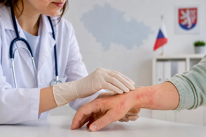 Чехия столкнулась с крупной вспышкой чесотки
