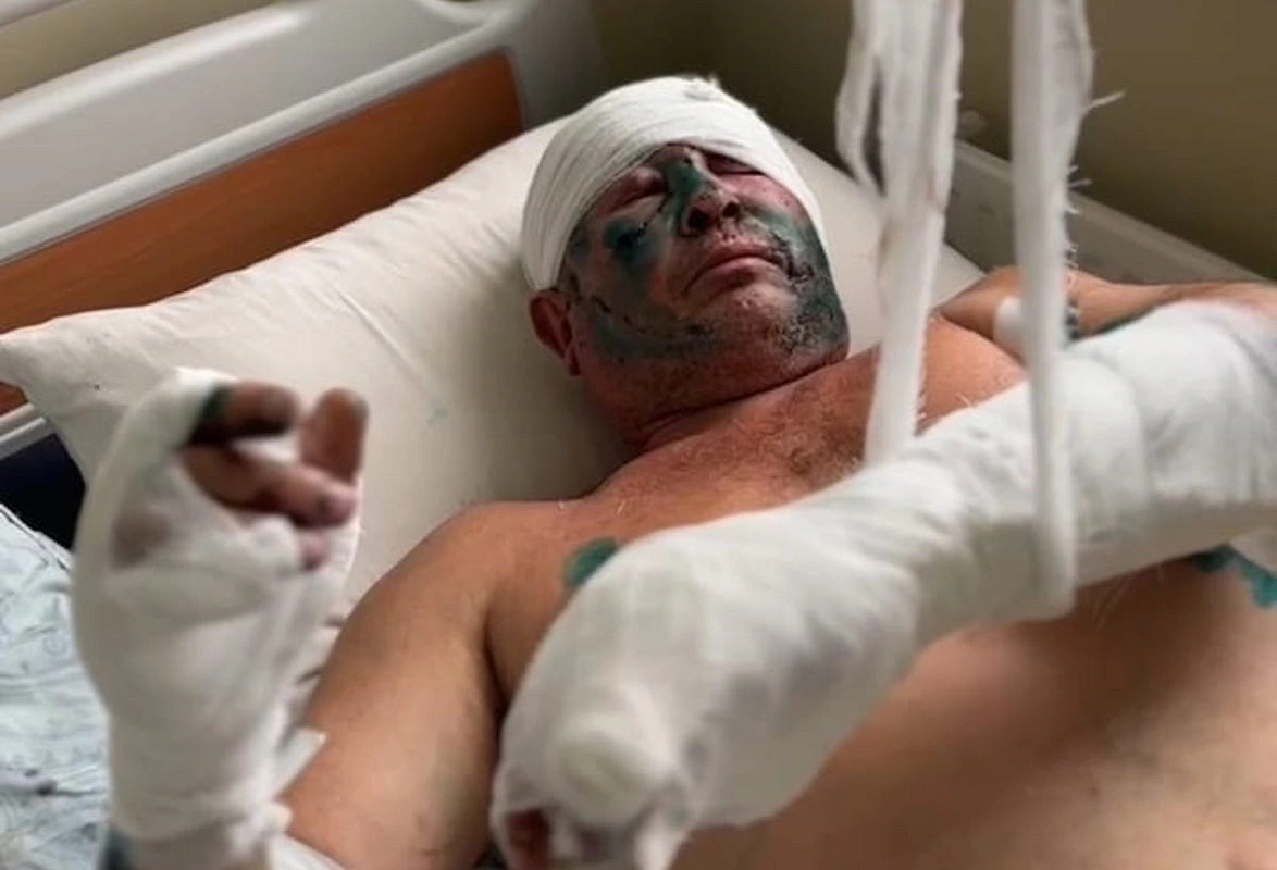 Близ Междуреченска медведь напал на мужчину