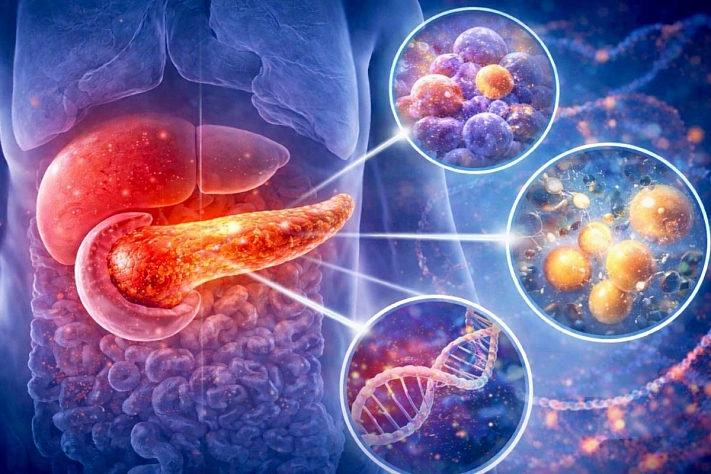 Учёные выяснили, что запускает рак поджелудочной железы на ранней стадии