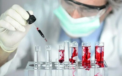 Группа крови влияет на риск раннего инсульта
