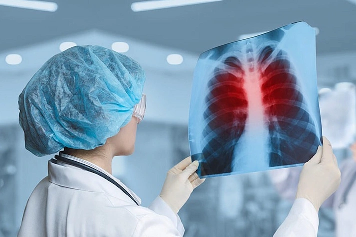 Доктор Абрамченко о профилактике и ранней диагностике туберкулёза