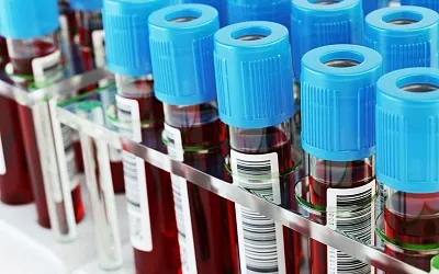 В России улучшилась статистика по заболеваемости ВИЧ